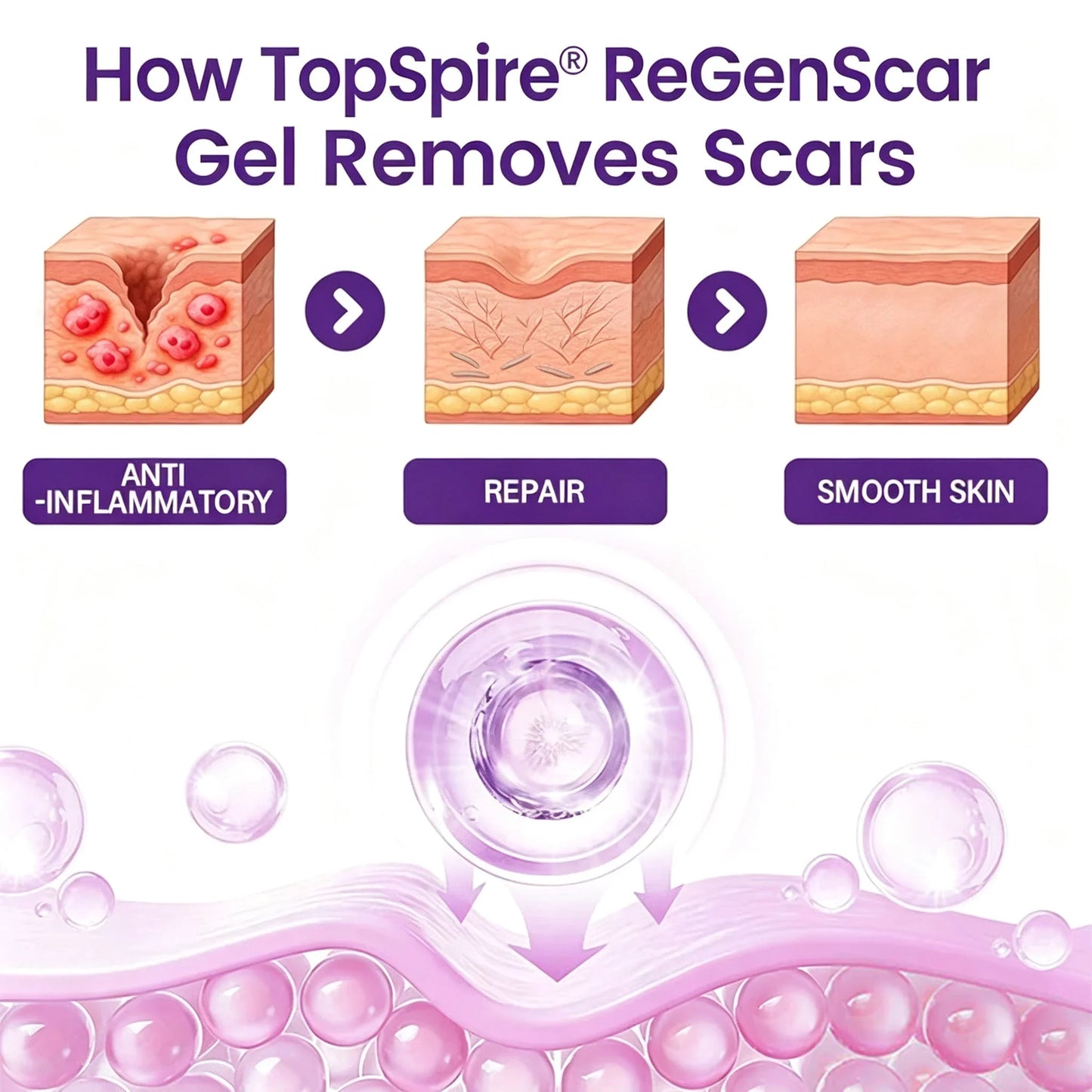 TopSpire® ReGenScar Stem Cell Scar Gel