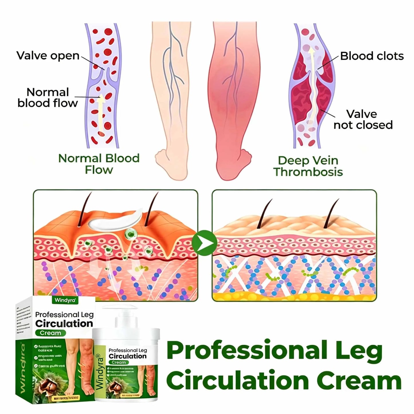Windyra® Professional Leg Circulation Cream