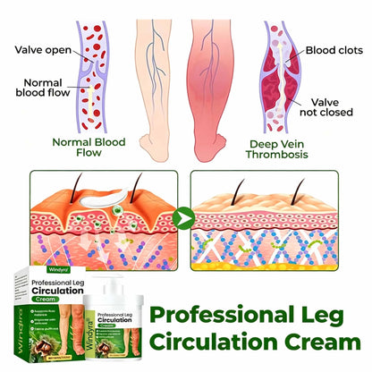 Windyra® Professional Leg Circulation Cream