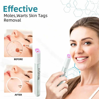 Windyra™ All-in-One CO₂ Laser Eraser Pen | Removes Moles, Warts, Skin Flaws & Pigmentation