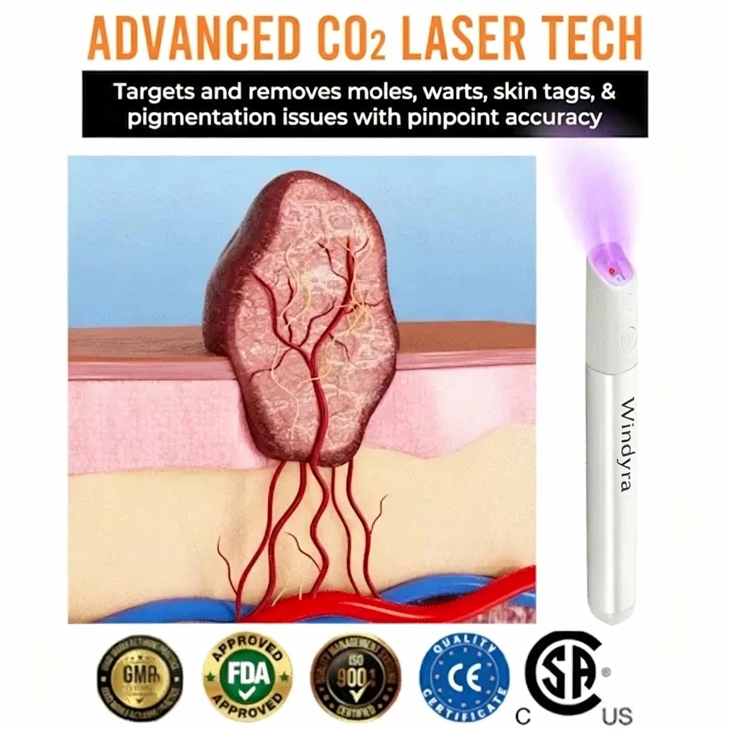 Windyra™ All-in-One CO₂ Laser Eraser Pen | Removes Moles, Warts, Skin Flaws & Pigmentation