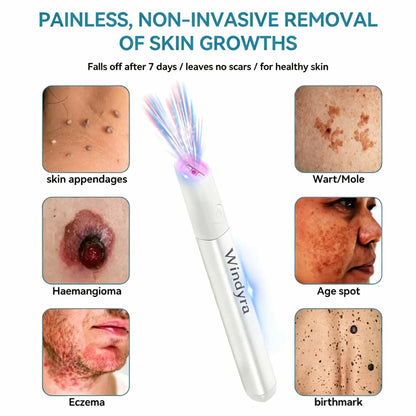 Windyra™ All-in-One CO₂ Laser Eraser Pen | Removes Moles, Warts, Skin Flaws & Pigmentation
