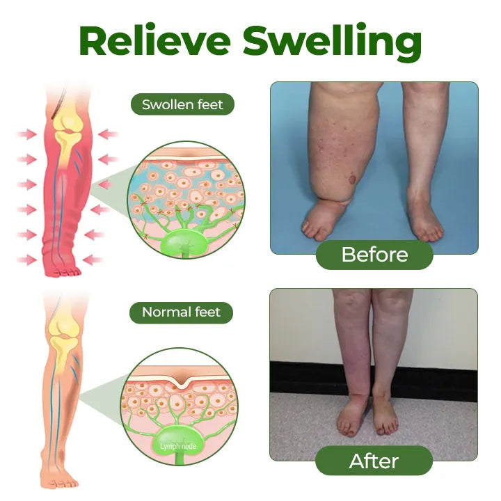 Windyra® Professional Leg Circulation Cream