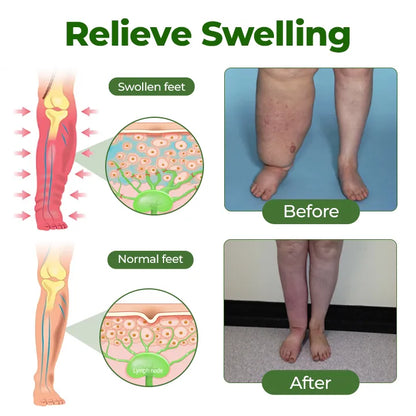 Windyra® Professional Leg Circulation Cream