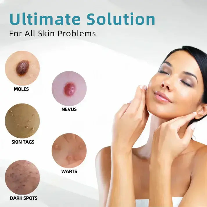 Windyra™ All-in-One CO₂ Laser Eraser Pen | Removes Moles, Warts, Skin Flaws & Pigmentation