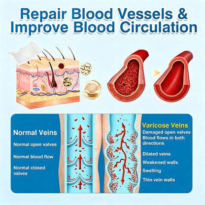 🏆✅️🏃Windyra® VeinRepair Microneedle Patch Roll⚡Instant Relief, Long-Term Results