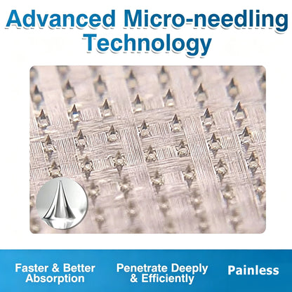 🏆✅️🏃Windyra® VeinRepair Microneedle Patch Roll⚡Instant Relief, Long-Term Results