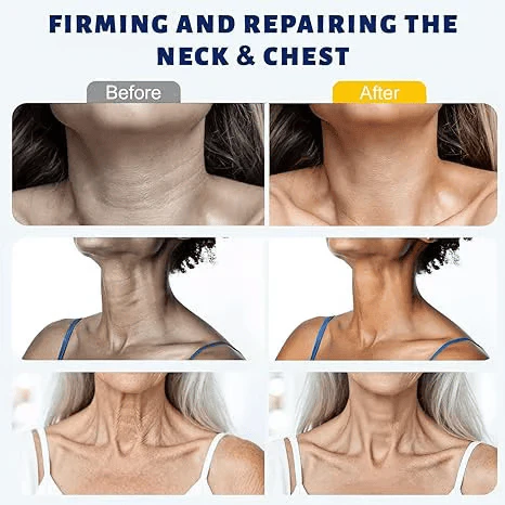 ✨ Windyra™ Instant Neck Lift Cream — 🧴 Infused with Retinol & Hyaluronic Acid | Firms the Neck, Reduces Wrinkles