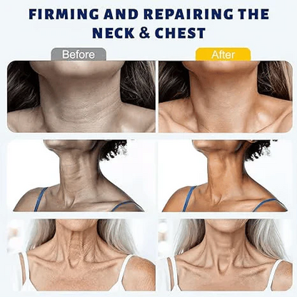 ✨ Windyra™ Instant Neck Lift Cream — 🧴 Infused with Retinol & Hyaluronic Acid | Firms the Neck, Reduces Wrinkles