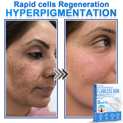🔥Last Day 80% OFF 👨‍⚕️  Bellevery® 2-in-1 Microneedle & Hydrocolloid Patch | Raised Moles,Acne,  Flat Warts & Skin Tags Remover | Improves Wrinkles, Scars & Blemishes | Invisible Pimple Patches for Face & Body