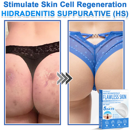 🔥Last Day 80% OFF 👨‍⚕️  Bellevery® 2-in-1 Microneedle & Hydrocolloid Patch | Raised Moles,Acne,  Flat Warts & Skin Tags Remover | Improves Wrinkles, Scars & Blemishes | Invisible Pimple Patches for Face & Body