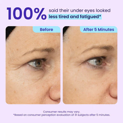 🔥Last Day 80% OFF-Windyra® Eye Bag Instant Eraser, Tightens, Firms, & Blurs Wrinkles