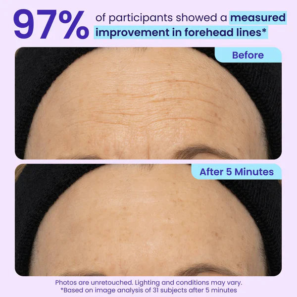 🔥Last Day 80% OFF-Windyra® Eye Bag Instant Eraser, Tightens, Firms, & Blurs Wrinkles