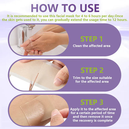 Windyra® Soluble Microneedle Botanical Skin Tag Removal Patch