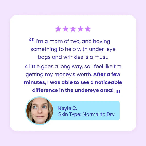 🔥Last Day 80% OFF-Windyra® Eye Bag Instant Eraser, Tightens, Firms, & Blurs Wrinkles