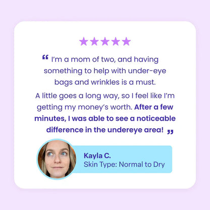 🔥Last Day 80% OFF-Windyra® Eye Bag Instant Eraser, Tightens, Firms, & Blurs Wrinkles