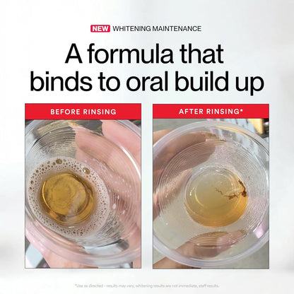 Windyra iD Stain Whitening Mouthwash, Gunk Removing Mouthwash for Fresh Breath
