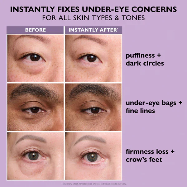 🔥Last Day 80% OFF-Windyra® Eye Bag Instant Eraser, Tightens, Firms, & Blurs Wrinkles