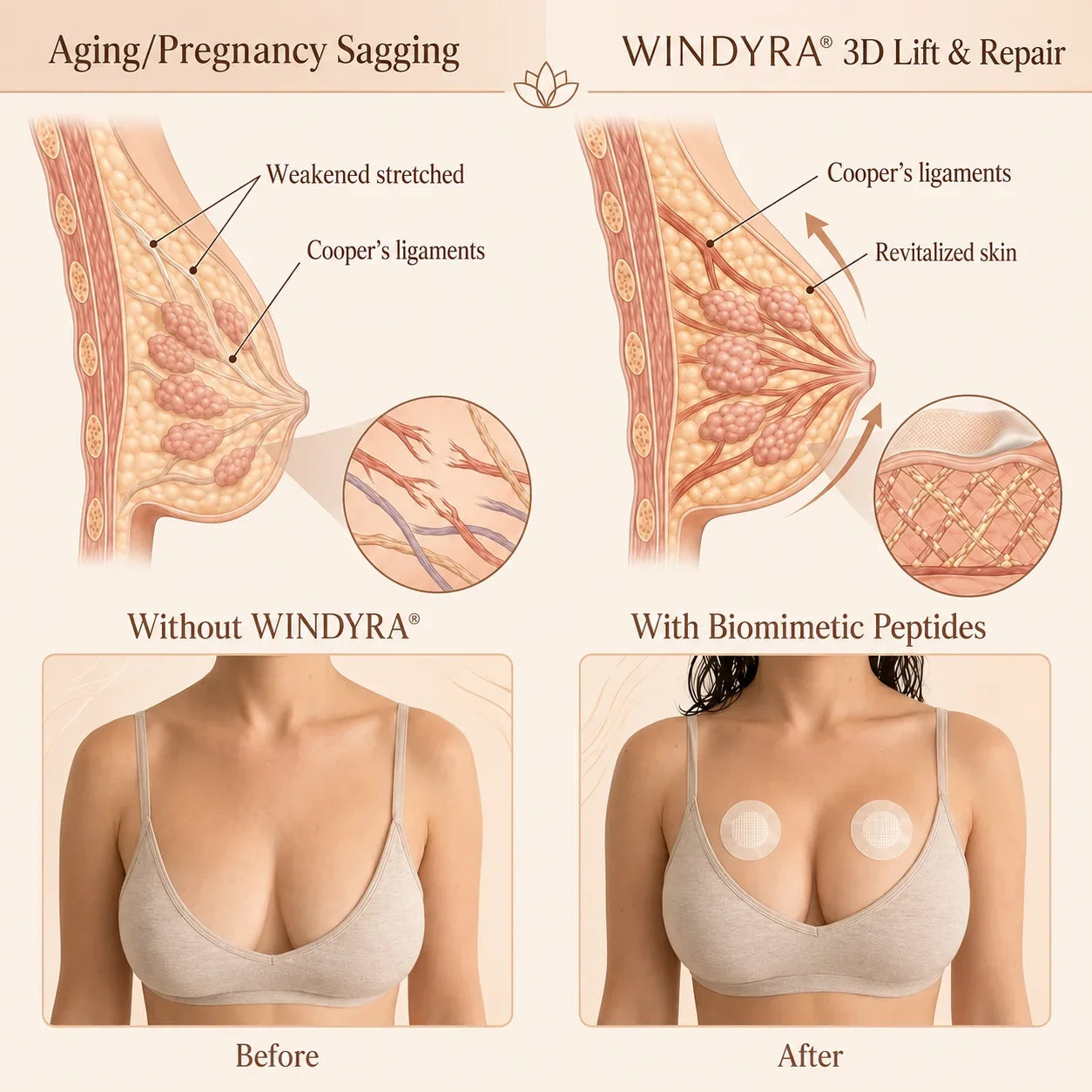 🔥Limited-time 80% sale-Windyra® Targeted Breast Enhancement Advanced Nano Microneedle Patch