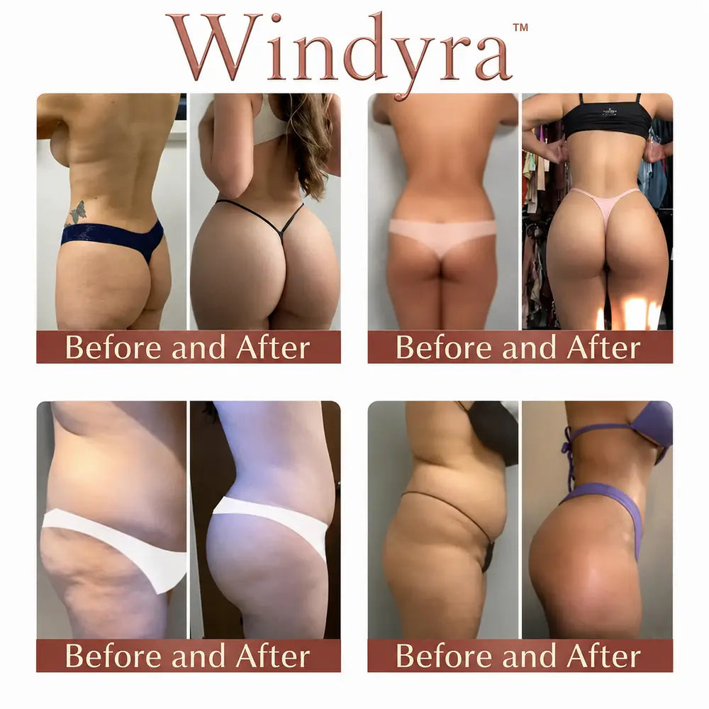 Windyra™ CurveSculpt Micro-Patch ✦ Sculpt • Firm • Smooth Lower Body Curves ✦ Micro-Needle Infusion System