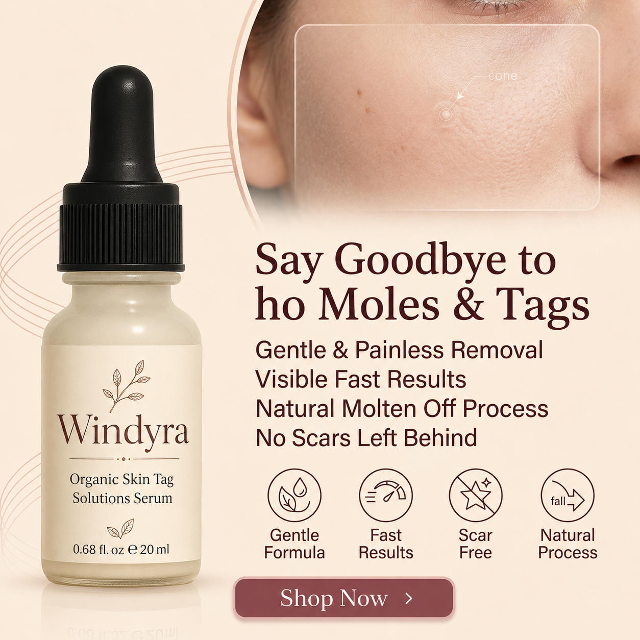 🔥LAST DAY Buy 2 Get 1 Free Windyra™️ Organic Skin Tag Remover Serum | All Natural For Warts