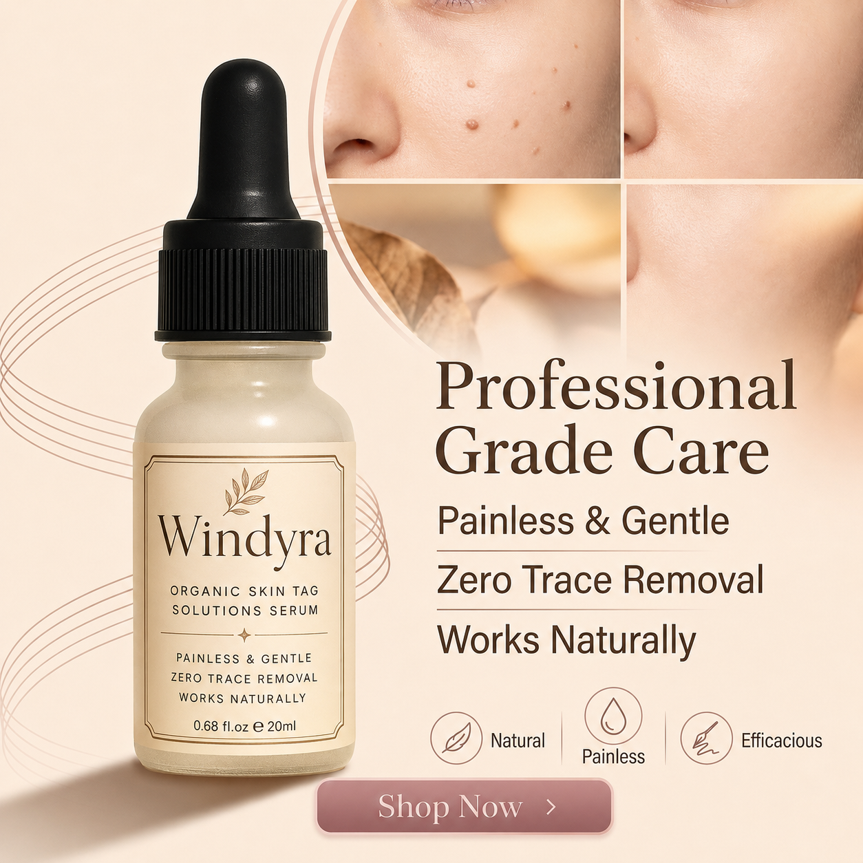 🔥LAST DAY Buy 2 Get 1 Free Windyra™️ Organic Skin Tag Remover Serum | All Natural For Warts