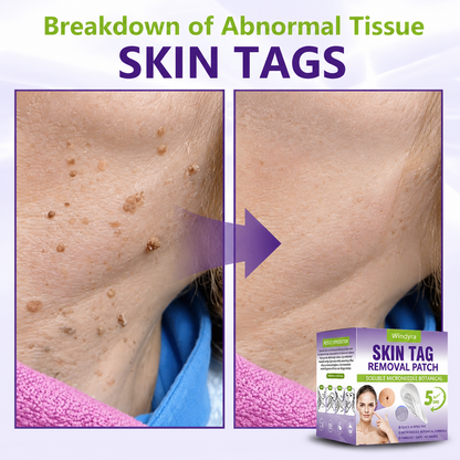 Windyra® Soluble Microneedle Botanical Skin Tag Removal Patch