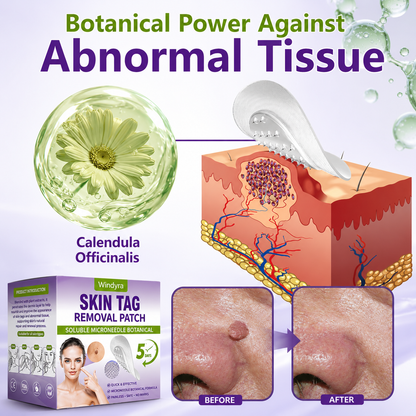 Windyra® Soluble Microneedle Botanical Skin Tag Removal Patch