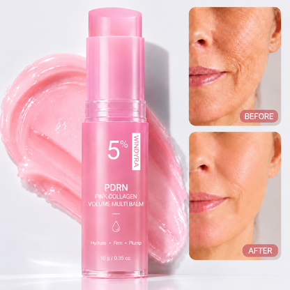 🔥LAST DAY 60% OFF Windyra Korean Pink Collagen Volume Multi Balm