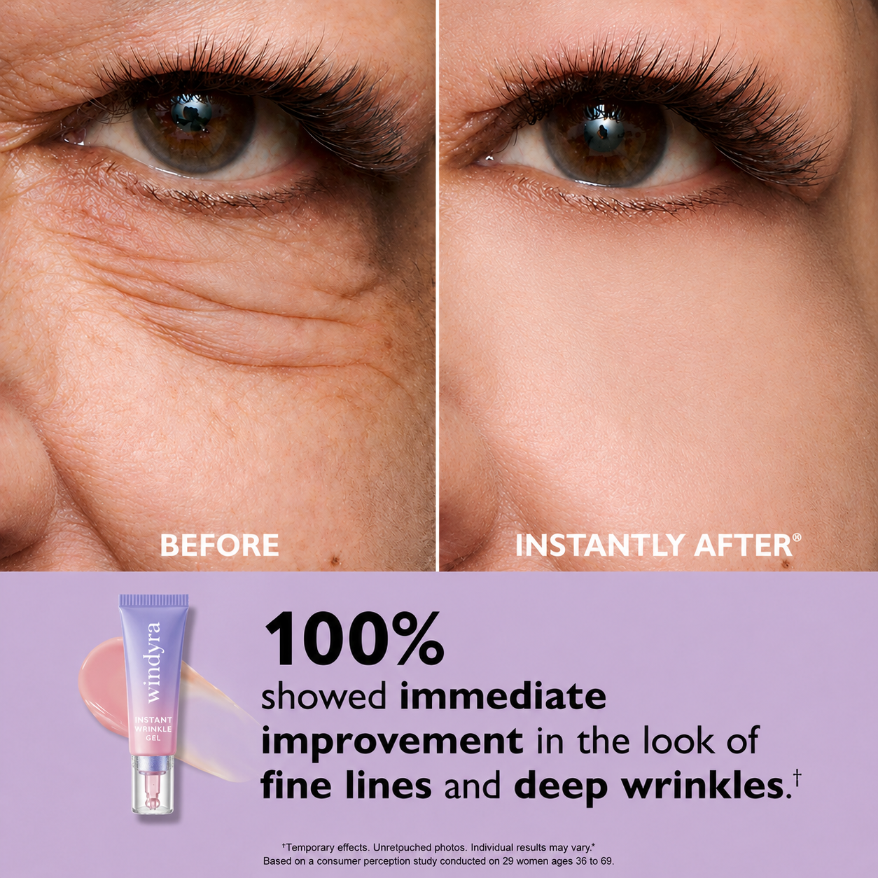 🔥Last Day 80% OFF-Windyra® Eye Bag Instant Eraser, Tightens, Firms, & Blurs Wrinkles