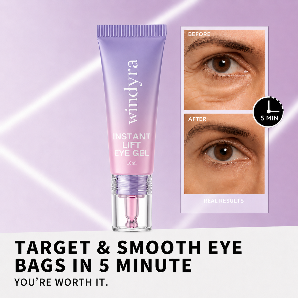 🔥Last Day 80% OFF-Windyra® Eye Bag Instant Eraser, Tightens, Firms, & Blurs Wrinkles