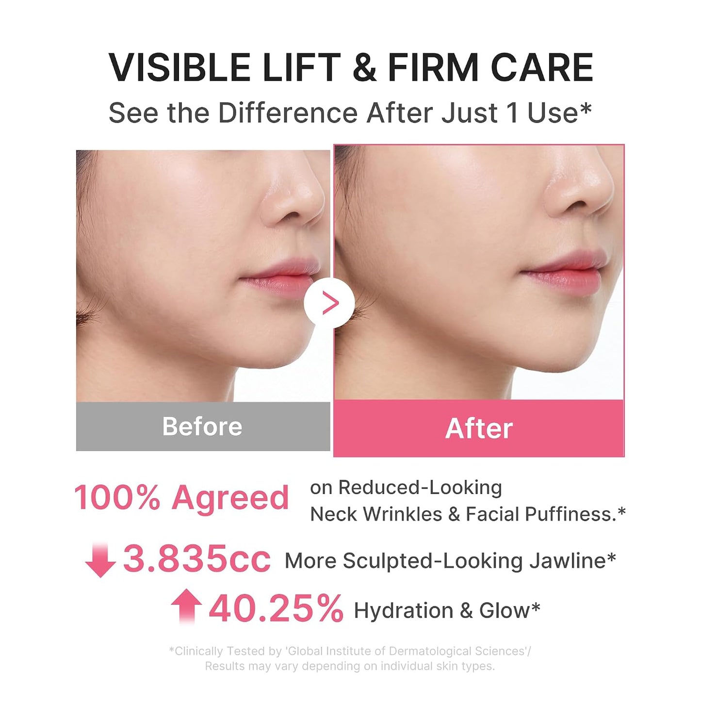 🔥LAST DAY Buy 2 Get 1 Free-Windyra PDRN Collagen Gua Sha Neck Wrinkle Cream