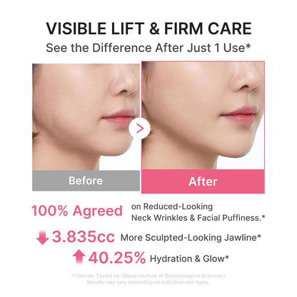 🔥LAST DAY Buy 2 Get 1 Free-Windyra PDRN Collagen Gua Sha Neck Wrinkle Cream